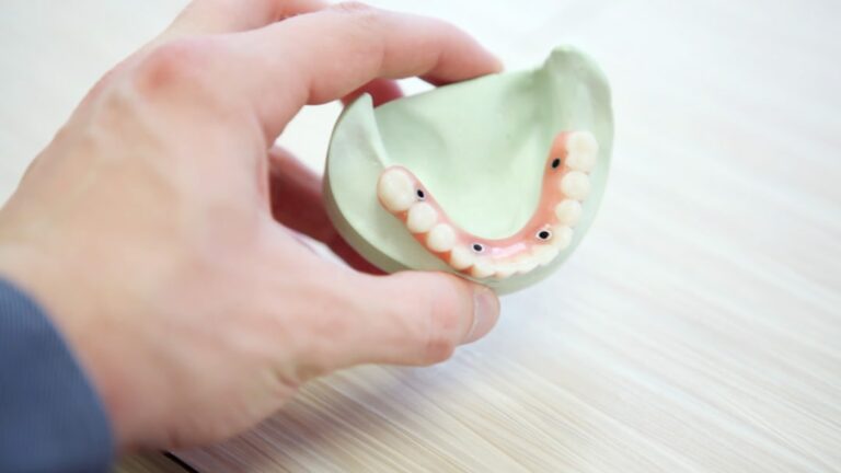 Photo Dental supplementary insurance for childrens orthodontics